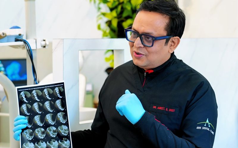 Dr. Ameet S. Dixit explaining a CBCT scan to a patient at Ark Dental Global, GK-1