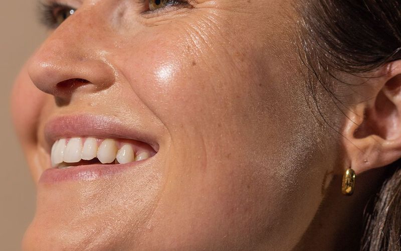 Cosmetic dentistry package